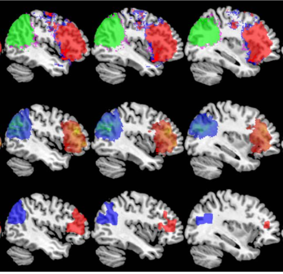Cluster Correction